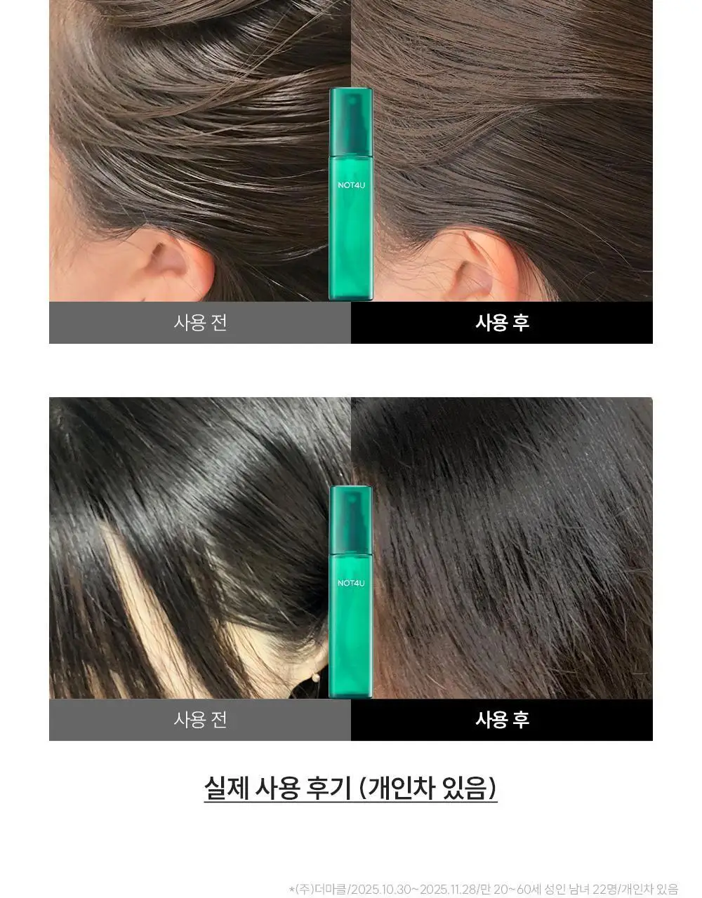 [지루성 두피케어] 낫포유 지성두피 트러블케어 미스트 80ml 기획 (+미니어처 30ml) 상세페이지 23